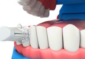 https://dreemdentistry.com/wp-content/uploads/2020/03/When-You-Have-Gingivitis-and-Need-Deep-Cleaning-300x209.jpeg