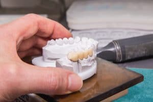 Technical shots of model on a dental prothetic laboratory.Dentist hand with plaster model