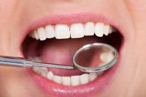 Close-up Of Woman Having Her Dental Checkup