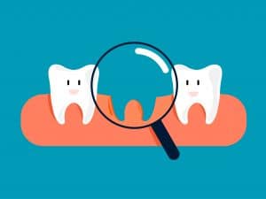 Fun concept about missing tooth. Looking for a tooth with a magnifying glass . Cartoon style. Vector illustration design.