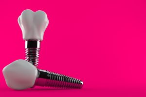 Dental implant isolated on purple background. 3d illustration