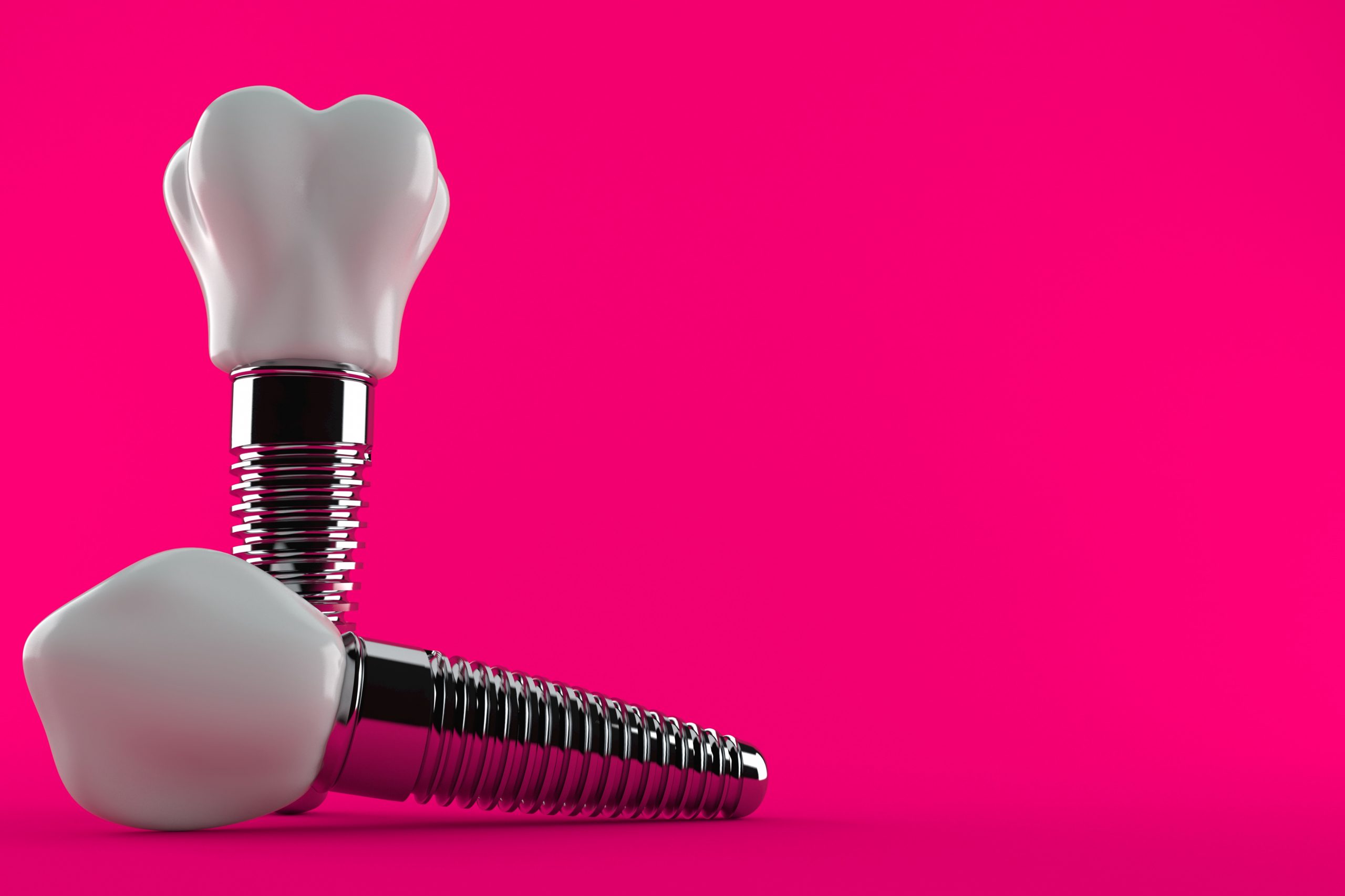 Dental implant isolated on purple background. 3d illustration