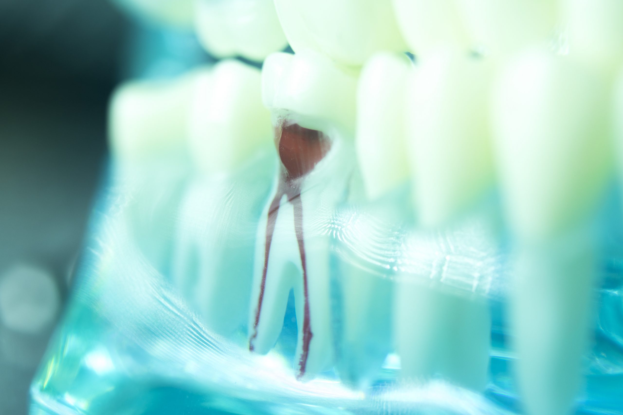 Dental tooth root canal dentists teeth model closeup.
