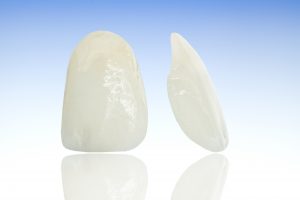 Metal free ceramic dental crowns