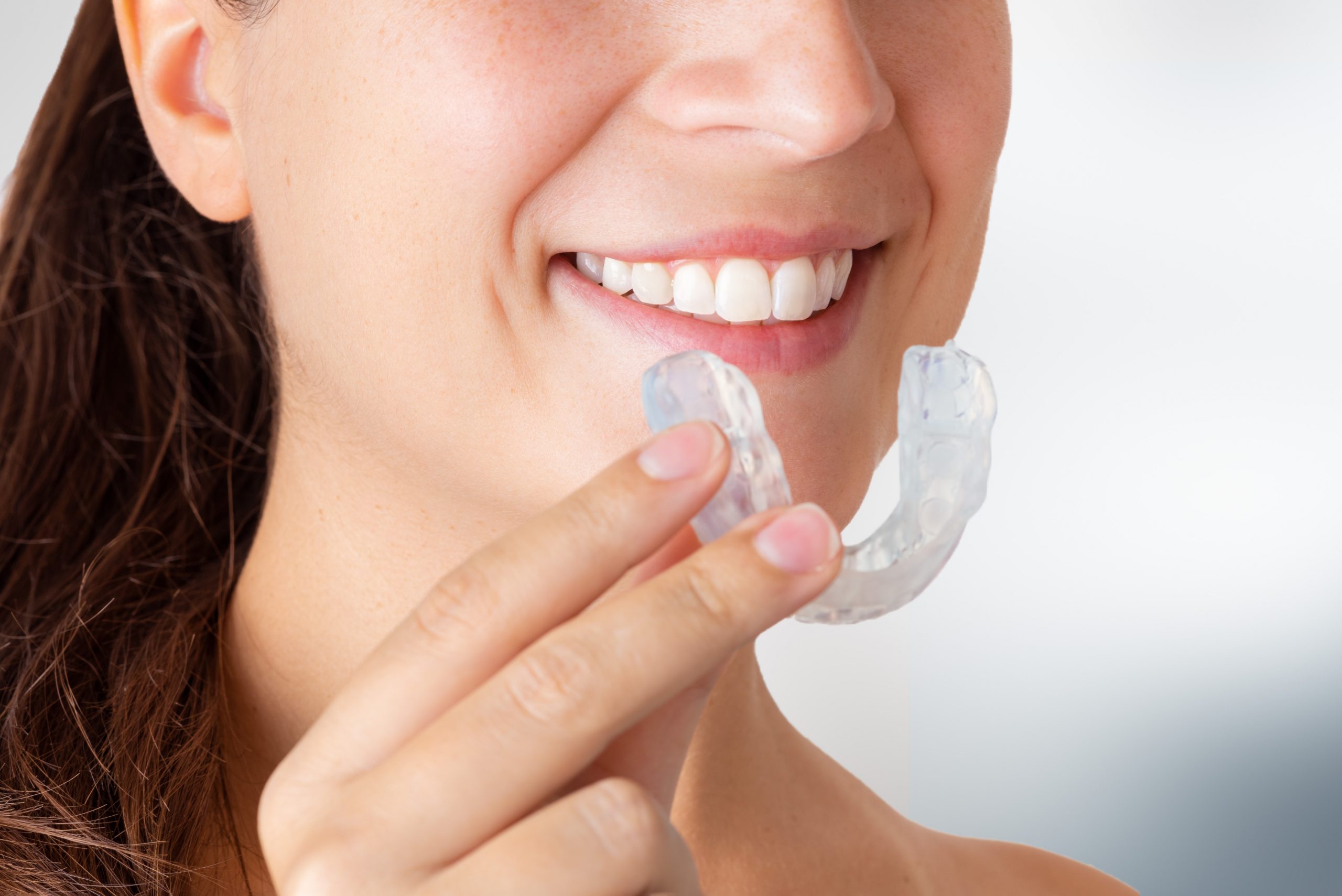 Woman wearing orthodontic silicone trainer. Invisible braces aligner. Mobile orthodontic appliance for dental correction. Placing a bite plate in mouth to save teeth from grinding caused by bruxism.