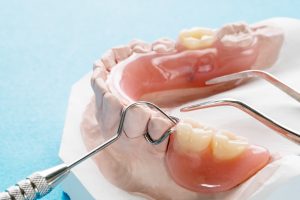 Close up, Artificial removable partial denture or temporary partial denture on blue ground.