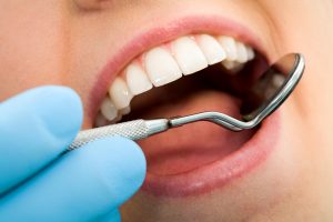 Close-up of female with open mouth during oral checkup at the dentist’s