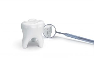 Broken tooth with dental mirror on white background. Creative idea