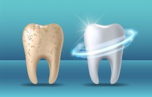 Teeth whitening 3d concept. Comparison of clean and dirty tooth before and after whitening treatment. Teeth whitening procedure, dental health and oral hygiene poster for dentistry design