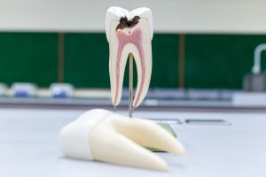 Tooth model for classroom education and in laboratory.