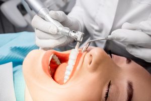 Dentist making professional teeth cleaning female young patient at the dental office. Close-up plan