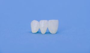 Metal free ceramic dental crowns isolated on a blue background