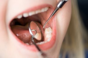 Dentist inspecting a child's teeth