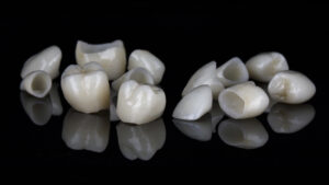 set of ceramic crowns for total work, shot on a black background