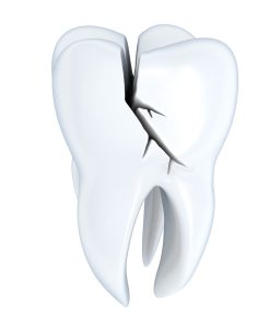 Broken tooth human Tooth (done in 3d, isolated)