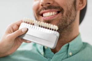 medicine, dentistry and healthcare concept - close up of dentist with tooth color samples choosing shade for male patient teeth at dental clinic