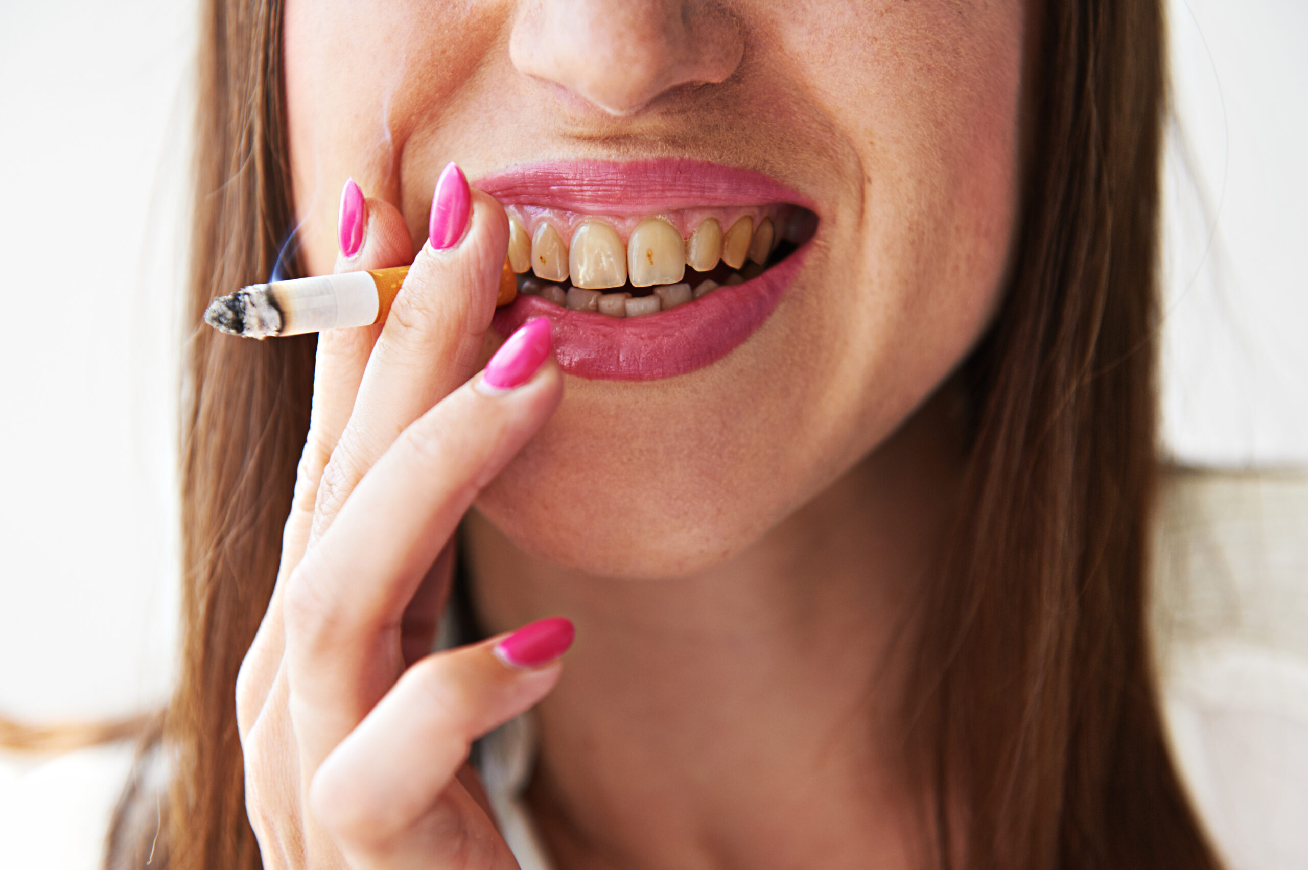 smiley woman with yellow dirty teeth holding cigarette