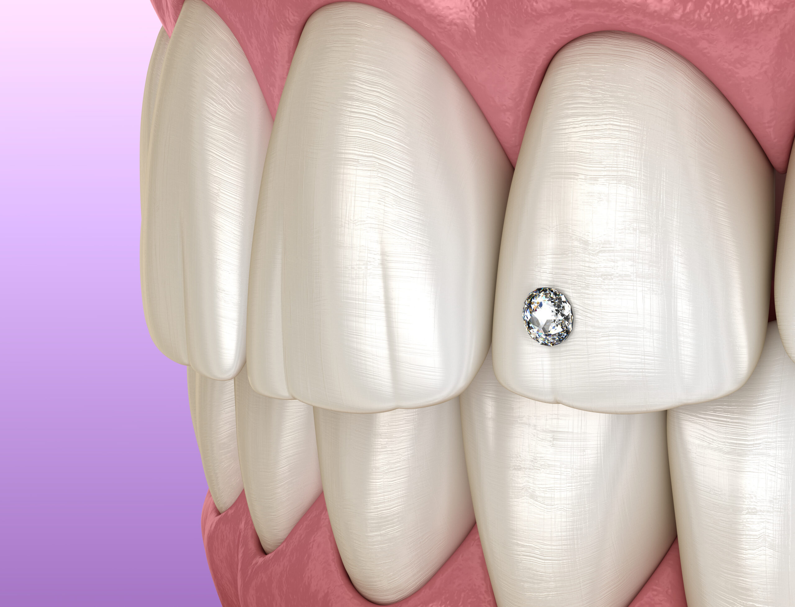 Have You Heard About Tooth Jewelry?