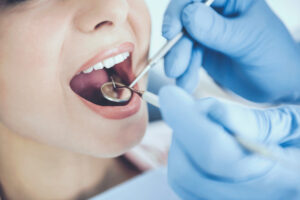 Doctor in Rubber Gloves. Examine Teeth of Patient. Closeup Checking Condition of Mouth. Healthcare Concept. Medicine and Care. Treatment at Dentist Office. Medical Treatment. Dental Hygiene.