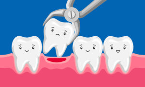 Illustration tooth is removed by forceps in oral cavity. Children dentistry characters. Kawaii facial expressions.