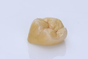 Particular single dental crown, molar in zirconium