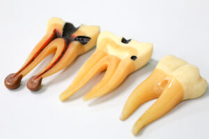 Tooth model for education in laboratory.