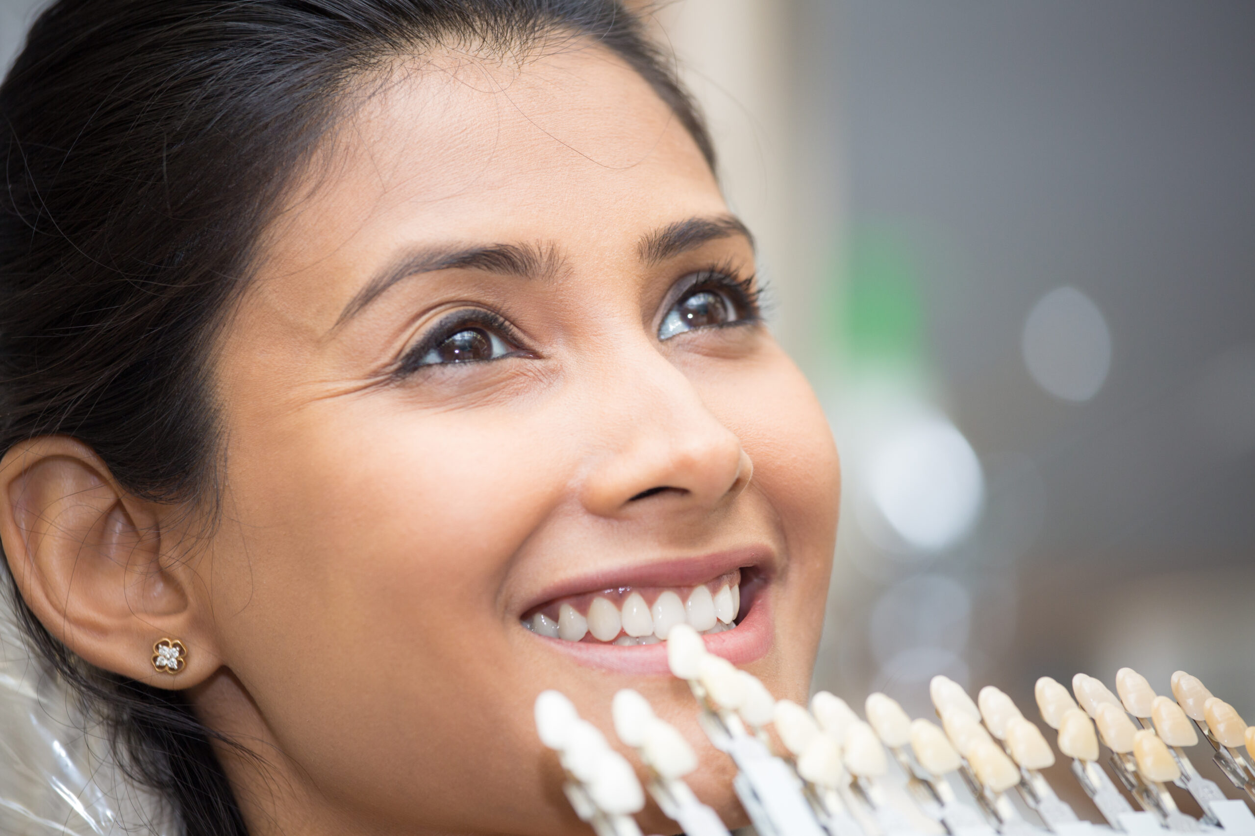 Closeup portrait of young woman getting shade of teeth selected by dental professional for treatment purposes