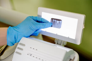 Dentist holding X-ray in stomatology office, focus on X-ray. Teeth care and tooth health. Stomatology equipment