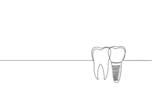 Single continuous line art anatomical human tooth silhouette implant. Healthy medicine recovery molar cavity concept design world oral health day one sketch outline drawing vector illustration art