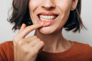 Close up shot of gum inflammation. Cropped shot of a young woman showing red bleeding gums isolated on a gray background. Dentistry, dental care