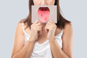 The woman show the picture of tongue problems, Illustration benign migratory glossitis on a brown paper, Behcet's Disease