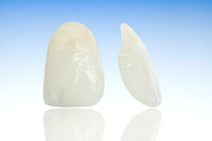 Metal free ceramic dental crowns