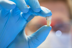 Young dentist is holding tooth - dentist office