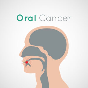 leawood oral cancer screening