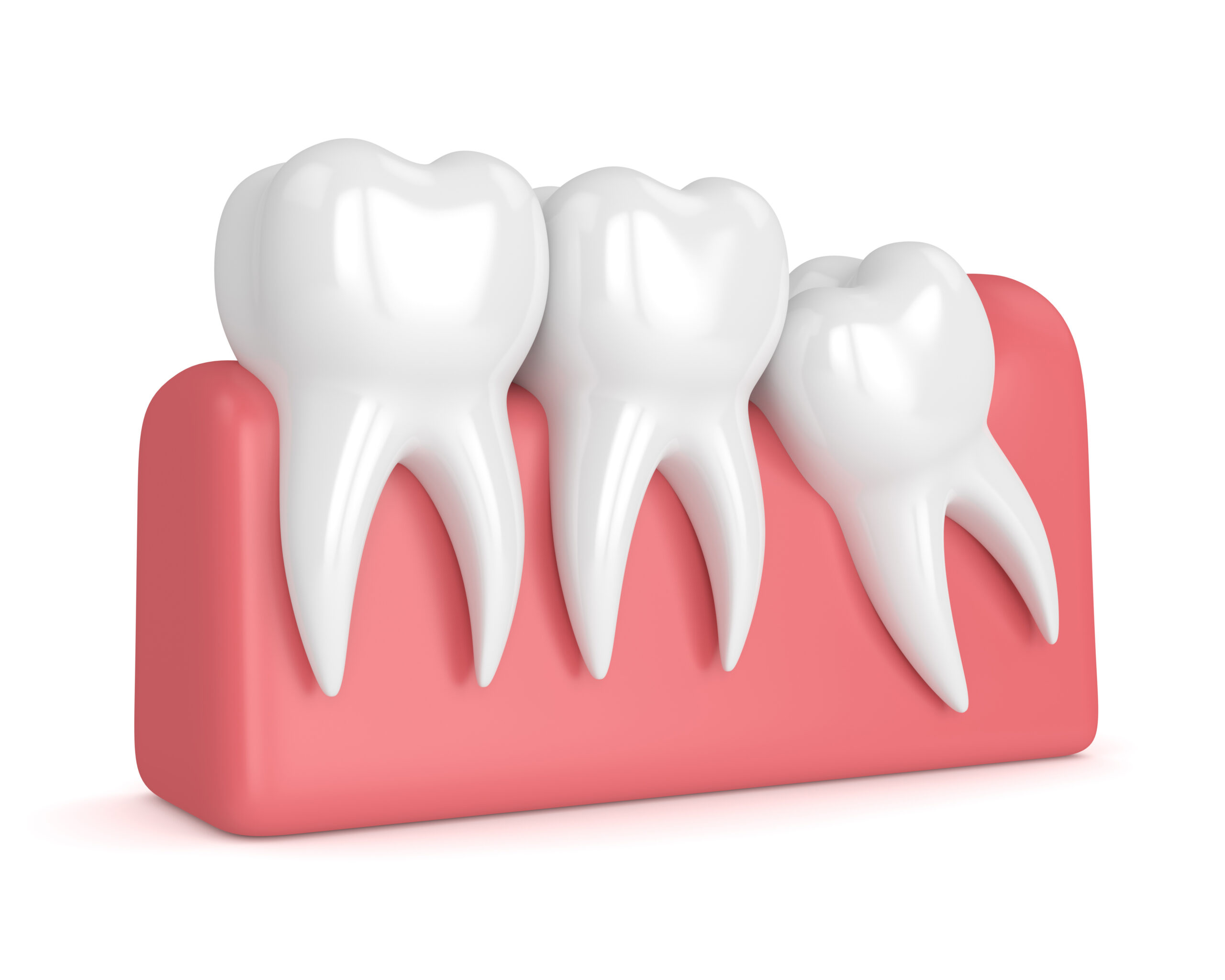 leawood tooth extraction