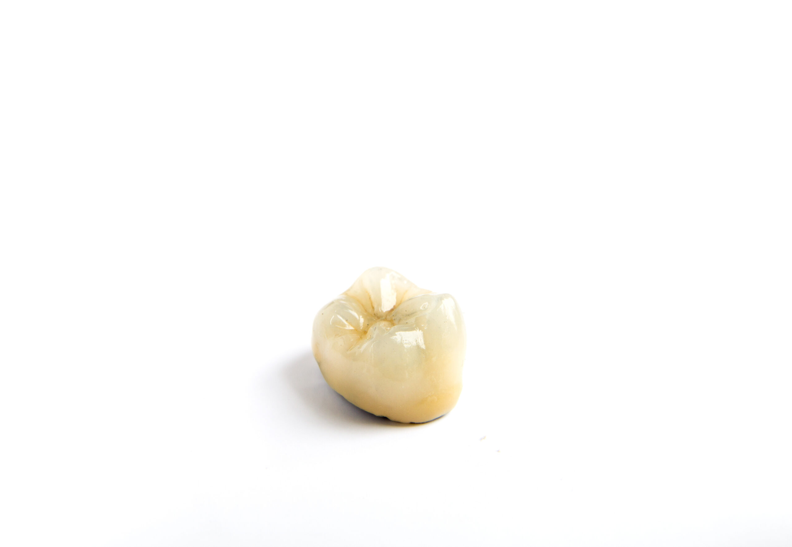leawood dental crowns