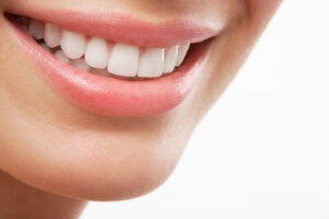 leawood veneers