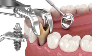 leawood restorative dentistry
