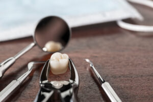 leawood tooth extraction