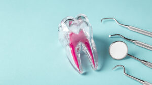 leawood root canal