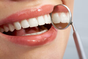 leawood dental fillings