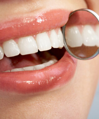 leawood dental fillings