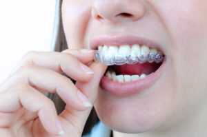 leawood invisalign