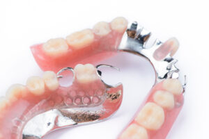 leawood dental prosthetics