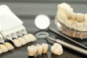 leawood dental bridge