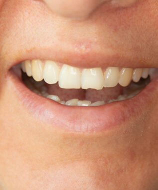 leawood emergency dentistry