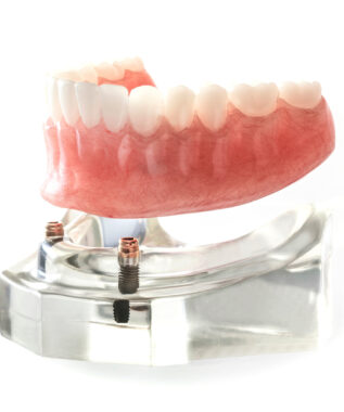 leawood implant dentures