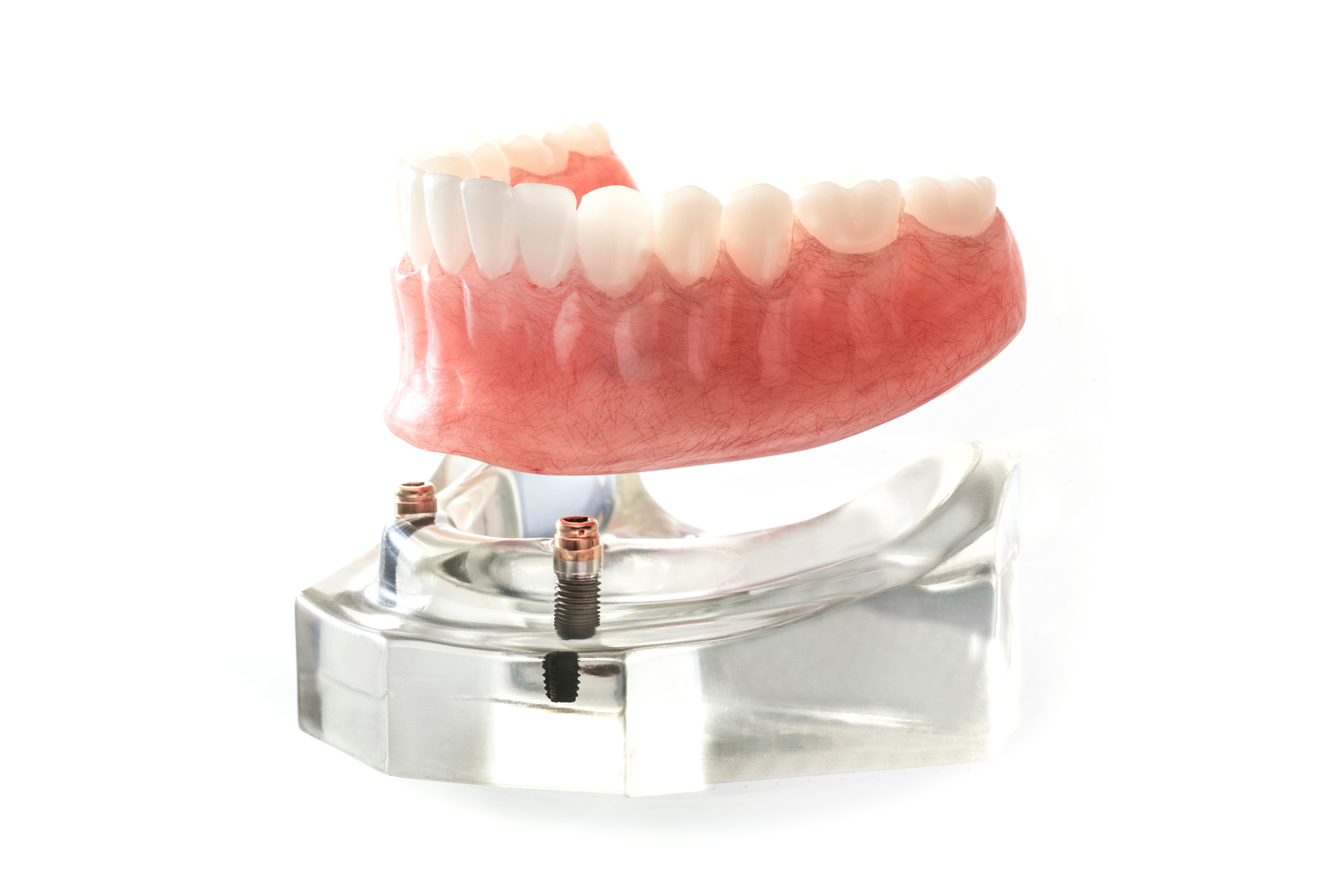 leawood implant dentures
