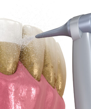 leawood deep cleaning