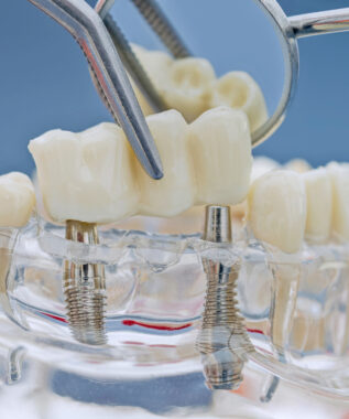 leawood prosthodontic dentistry